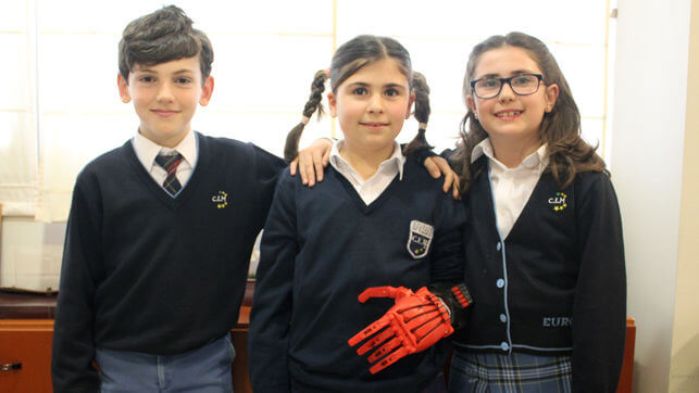 Child with 3D- printed prosthetic hand